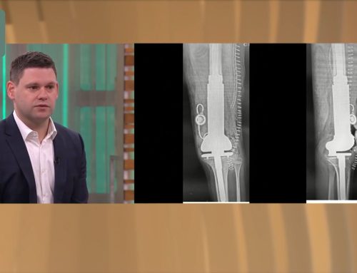 Prva neinvazivna ugradnja rastuće proteze kod djeteta u Hrvatskoj